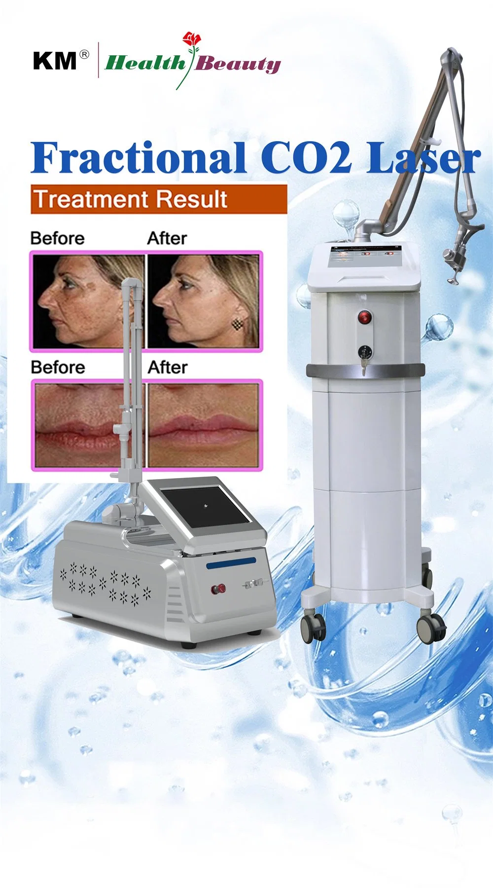 Fractional CO2 Laser Skin Resurfacing Machine New RF CO2 Vaginal Tightening Laser Vaginal Tightening CO2 Fractional Laser Suppliers 15 Years