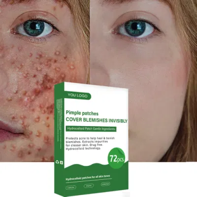 Cosmetics Facial Skin Care Acne Remover Hydrocolloid Patches Pimple Patch Acne Patch