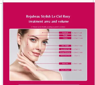 Le Ciel Rosy Plla Filler (CE) Royal Rejubeau Stylish Le Ciel Rosy Is a Medical Device for Treating Severe Facial Wrinkle