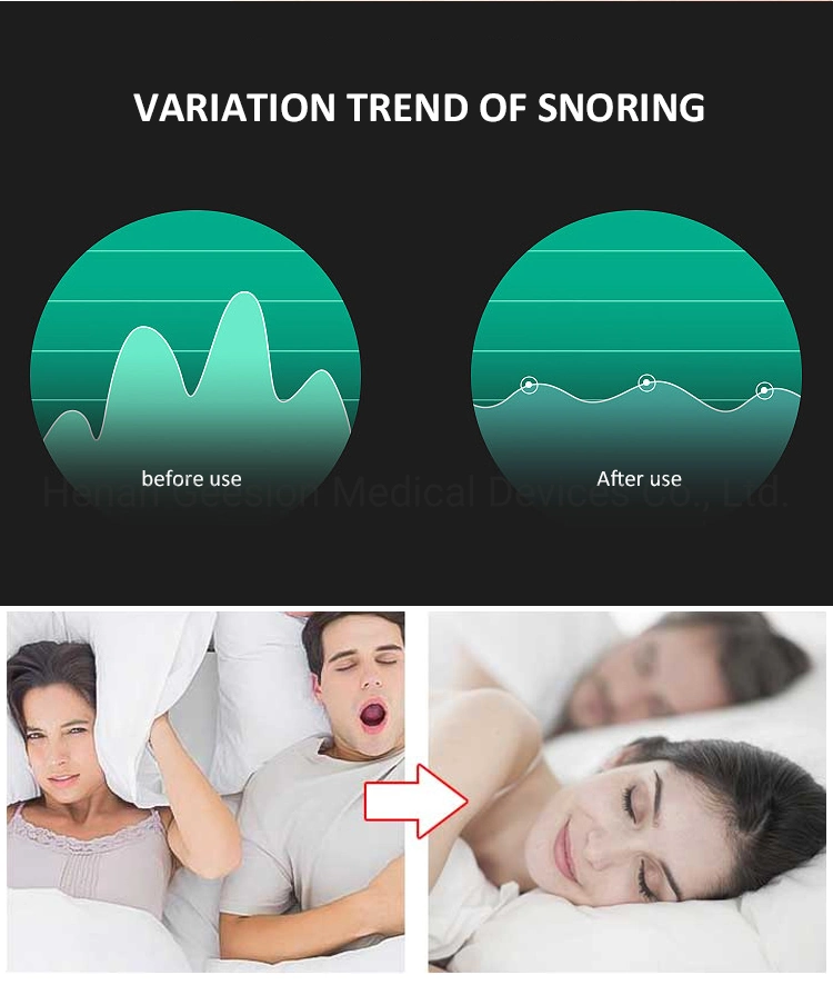 Anti Snoring Ring Reduce Snoring Caused by Nasal