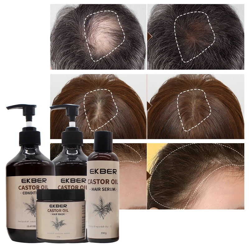 Private Label Anti-Hair Loss Castor Hair Care Set for Hair and Scalp Care Oil