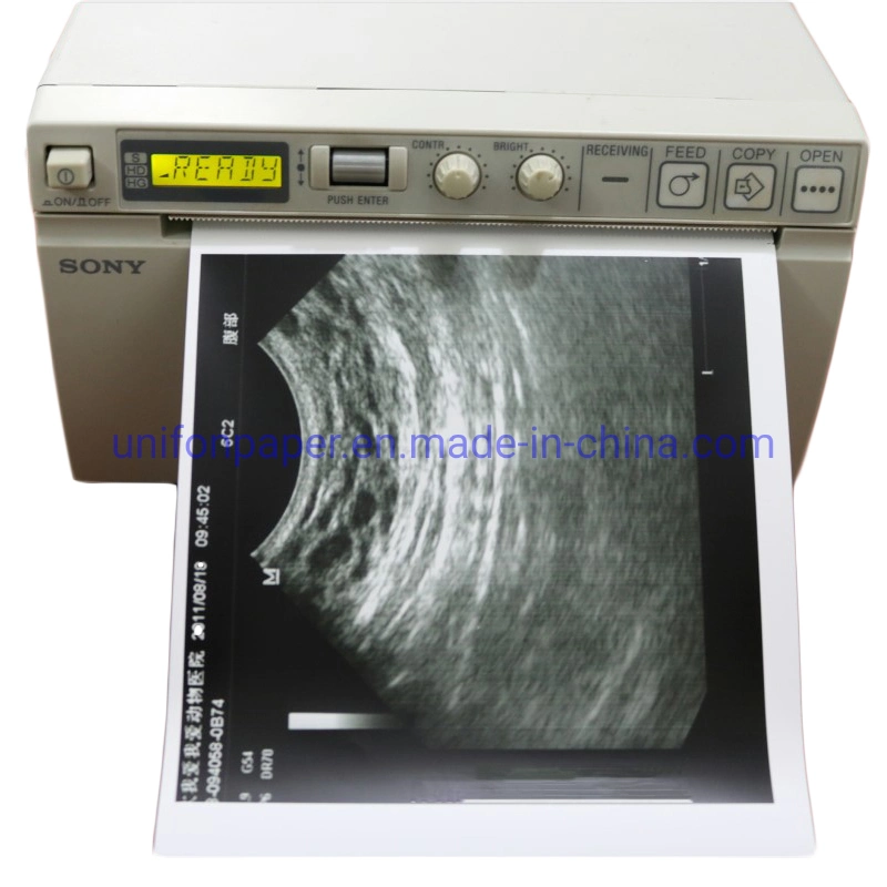 Ultrasound Printer Paper Glossy Thermal Upp-110hg Upp-110s Paper for Sony MD400 Ultrasound Machine