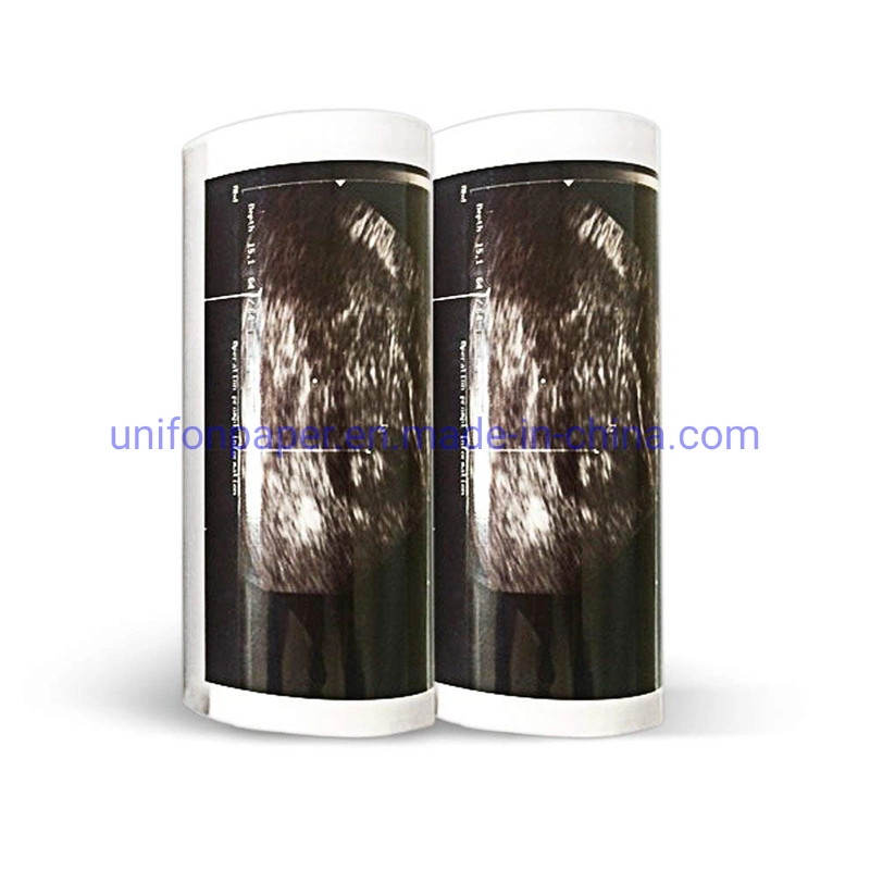 Ultrasound Printer Paper Glossy Thermal Upp-110hg Upp-110s Paper for Sony MD400 Ultrasound Machine