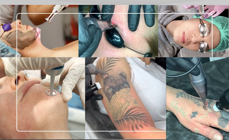 Dali Beauty Picosecond Picolaser Tattoo Removal Q Switched ND YAG Laser Spot Pigment Alex Laser Tattoo Remove Carbon Peeling Black Doll Skin Whitening