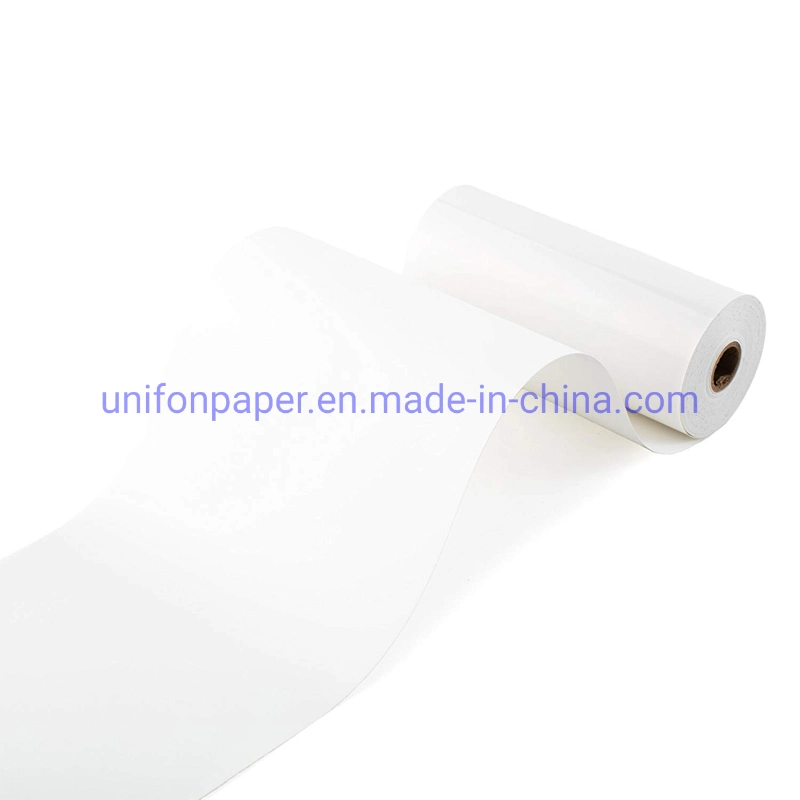 Ultrasound Printer Paper Glossy Thermal Upp-110hg Upp-110s Paper for Sony MD400 Ultrasound Machine