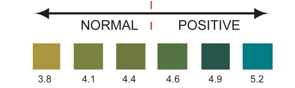 Physical Analysis BV-pH Bacterial Women Vaginal Healthy Test