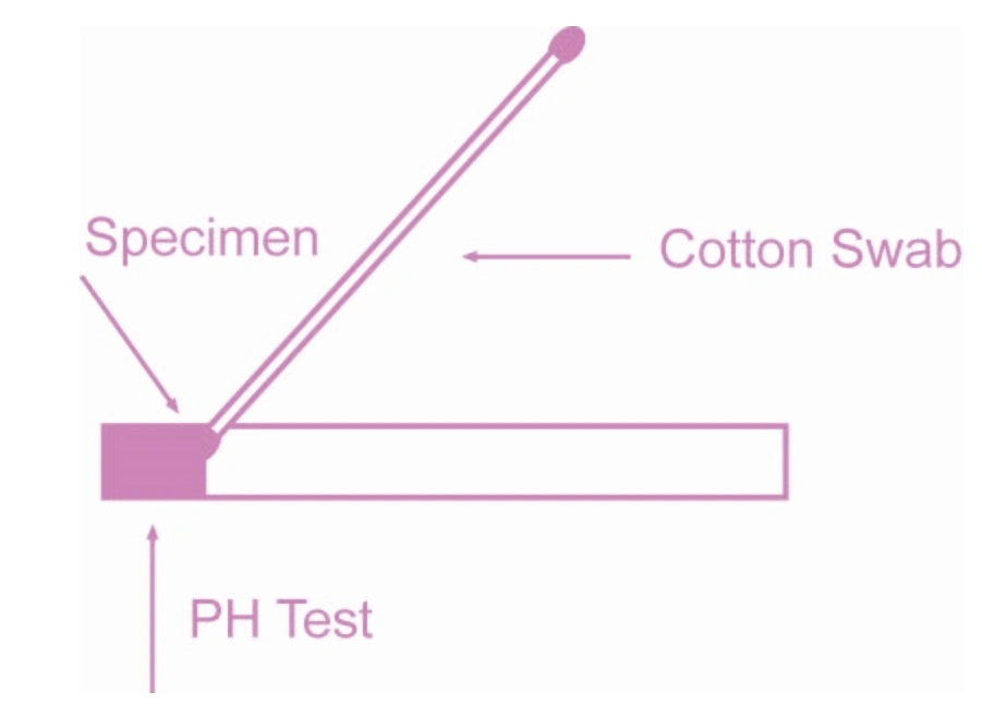 Physical Analysis BV-pH Bacterial Women Vaginal Healthy Test