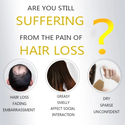 Prevenzione della perdita dei capelli Oily i capelli controllo del cuoio capelluto &amp; ricrescita Aumento della crescita dei capelli tonico