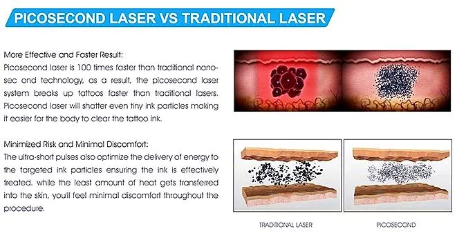 Dali Beauty Picosecond Picolaser Tattoo Removal Q Switched ND YAG Laser Spot Pigment Alex Laser Tattoo Remove Carbon Peeling Black Doll Skin Whitening