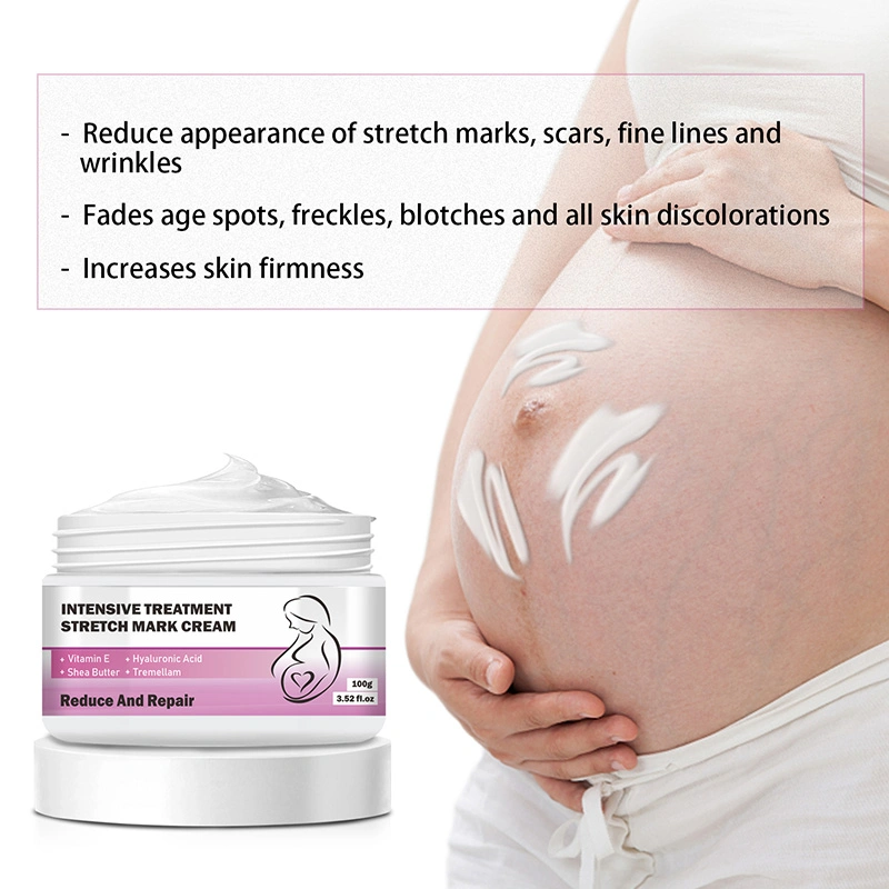 Custom Logo Pregnancy Women Skin Care Body Repair Acne Scar Removal Cream Natural Stretch Marks Cream Private Label