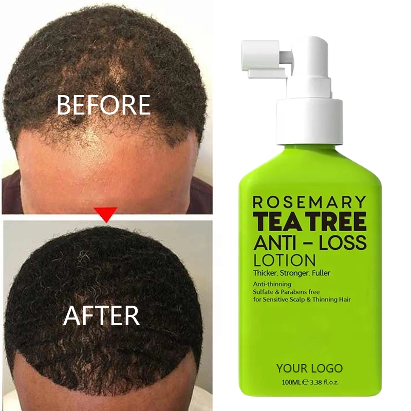 OEM Deep Nourishing Dry Scalp Treatment Hair Loss Hair Growth Tonic