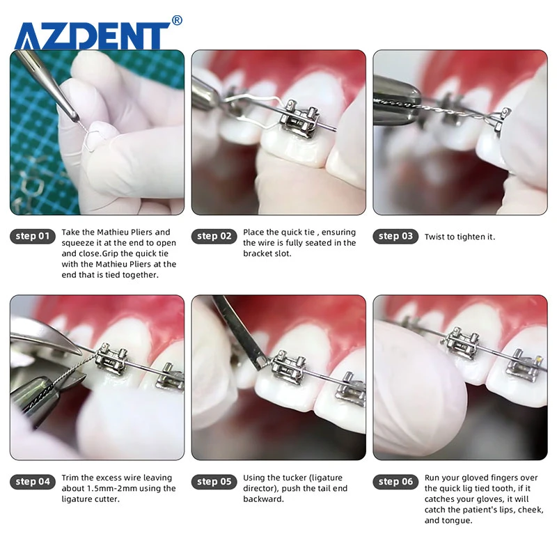 Azdent 100PCS Dental Preformed Ligature Ties Long Short Twist Orthodontic Wire