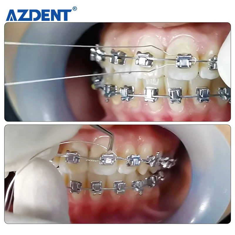 Azdent 100PCS Dental Preformed Ligature Ties Long Short Twist Orthodontic Wire