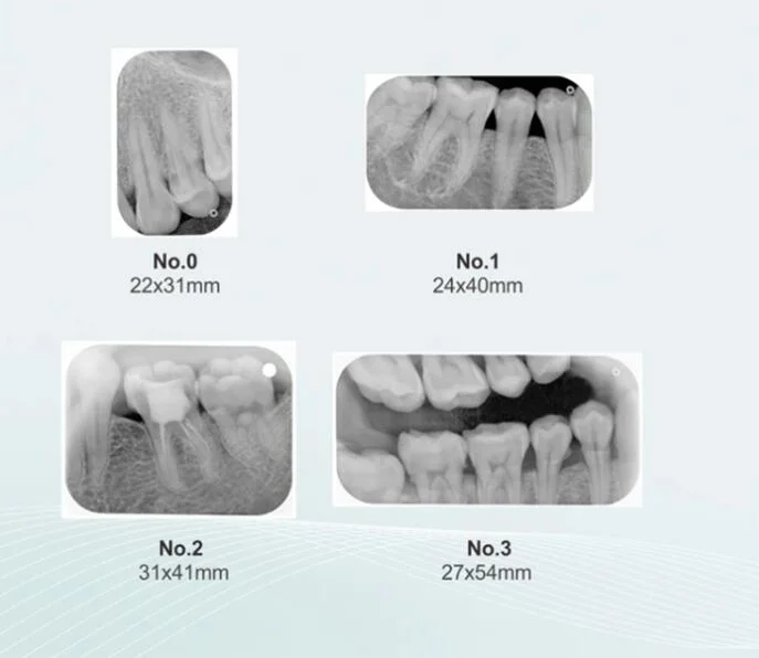 X-ray Film Scanner Dental X-ray Phosphor Image Plate