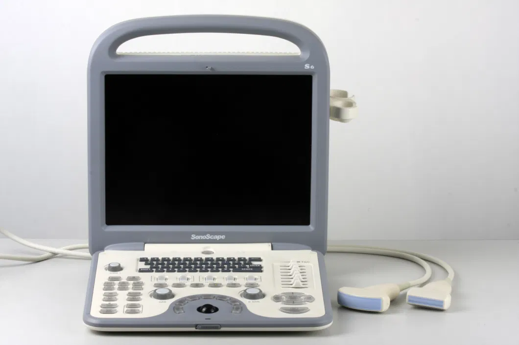 Sonoscape S6 Portable Color Doppler Ultrasound Machine for People