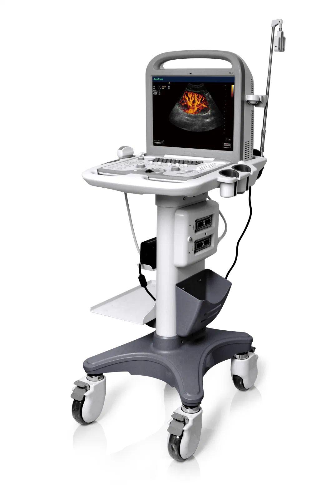 Sonoscape S6 Portable Color Doppler Ultrasound Machine for People