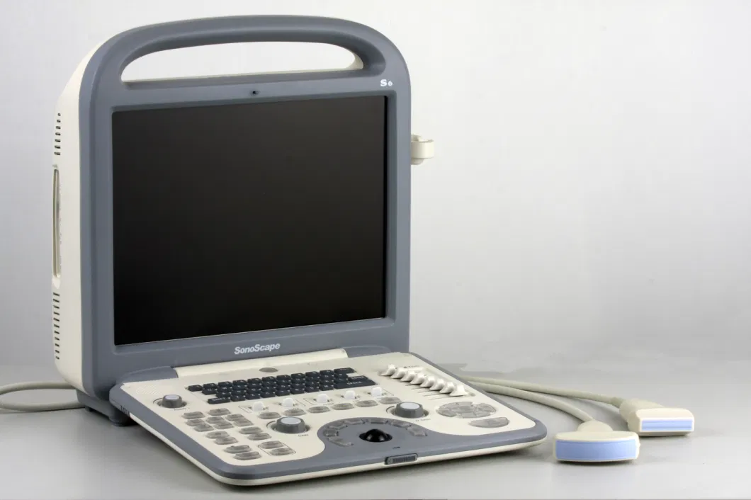 Sonoscape S6 Portable Color Doppler Ultrasound Machine for People