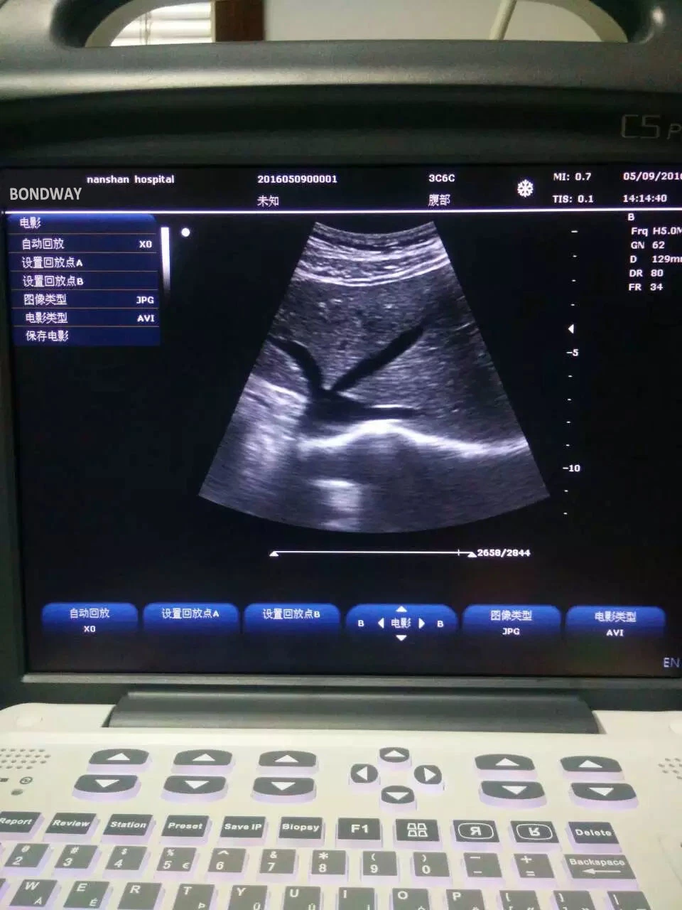 Factory Low Price Full Digital Portable Color Doppler Diagnostic Ultrasound Imaging System, with 12-1 Inch High-Resolution LCD, Medical Ultrasonic Machine
