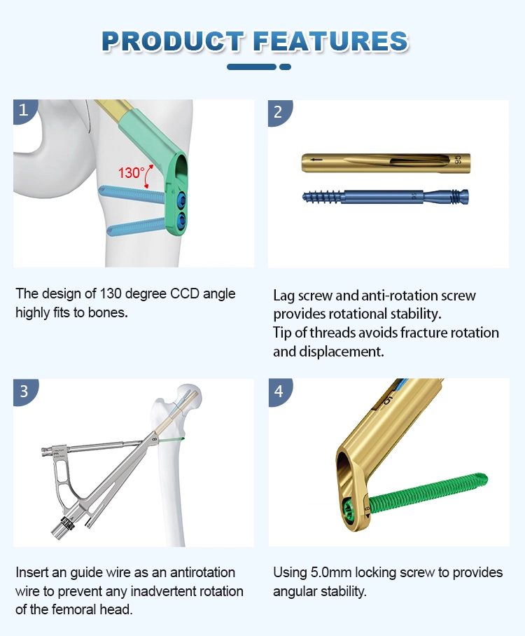 Orthopedic Locking Plates and Screws Femoral Neck Dynamic Cross Screw System