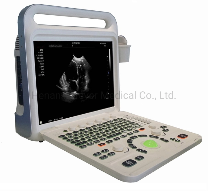 Gold Supplier Medical Instrument Laptop Ultrasound Diagnostic System