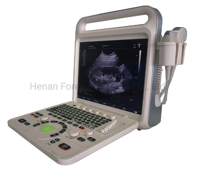 Gold Supplier Medical Instrument Laptop Ultrasound Diagnostic System