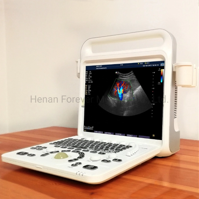 Gold Supplier Medical Instrument Laptop Ultrasound Diagnostic System