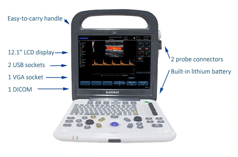 Factory Low Price Full Digital Portable Color Doppler Diagnostic Ultrasound Imaging System, with 12-1 Inch High-Resolution LCD, Medical Ultrasonic Machine