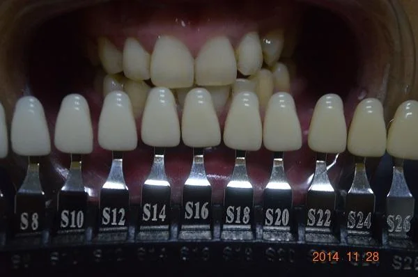 2023 Hot Sell Products Dental Dentist Shade Chart Teeth Whitening Shade Guide with 20 Teeth Color