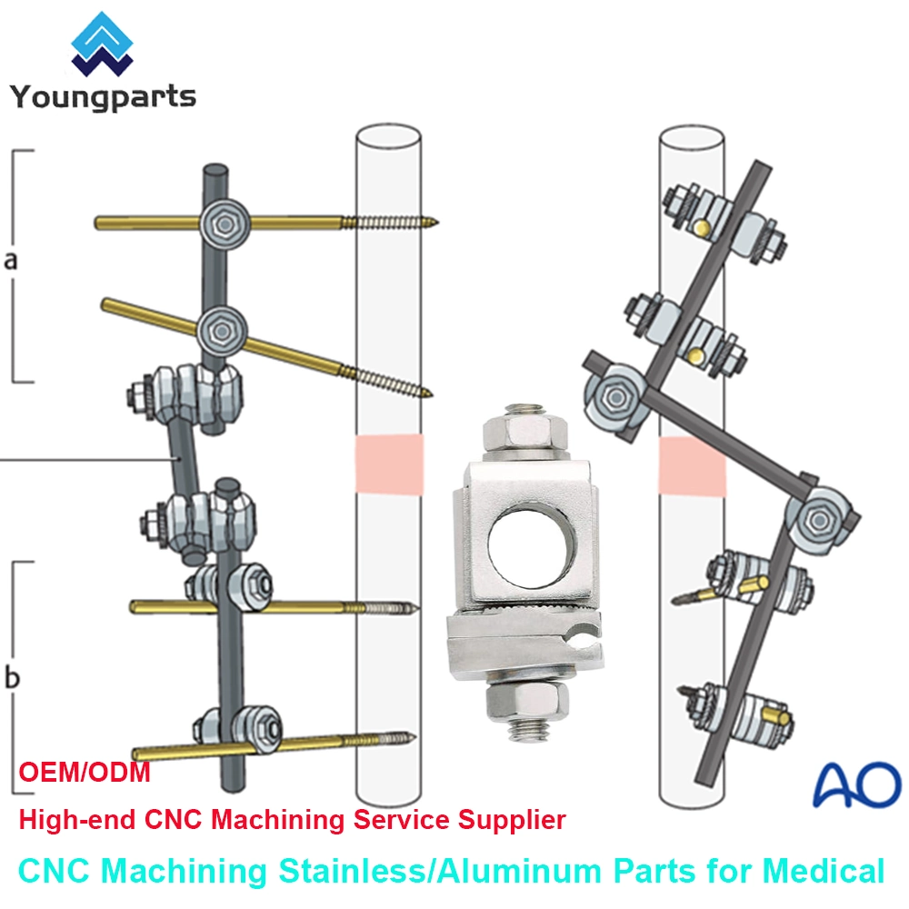 Bone Screws: Reliable Fastening Devices for Orthopedic Surgeries