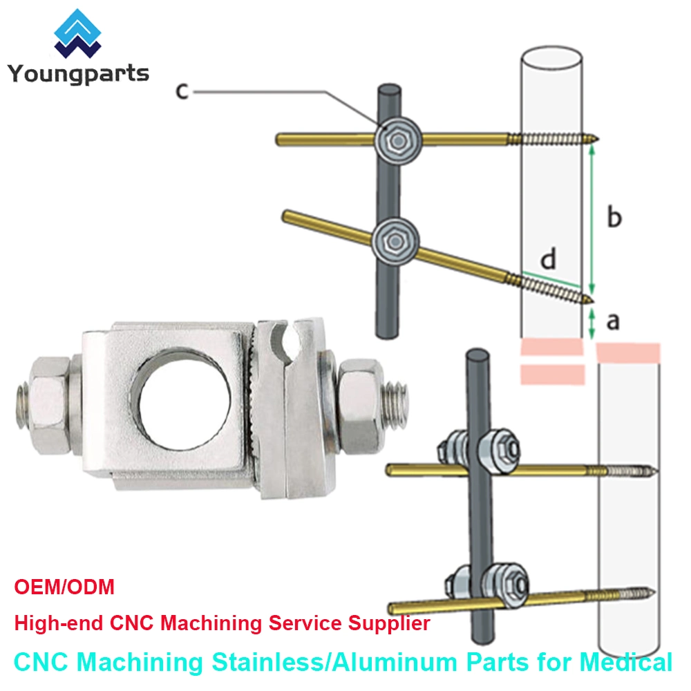 Youngparts Rod Clamp External Fixation Orthopedic Surgical Instruments Hoffman Rod Coupling for 5mm Rods or Posts Stryker System