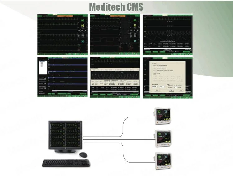 CE Approved Patient Monitor with Hight Brightness Colorfull Touch Screen