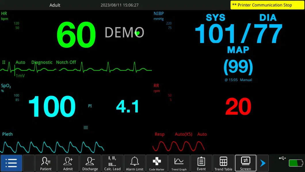 Large Screen Touch Medical Devices EKG Multiparameter Monitors Portable Patient Monitor
