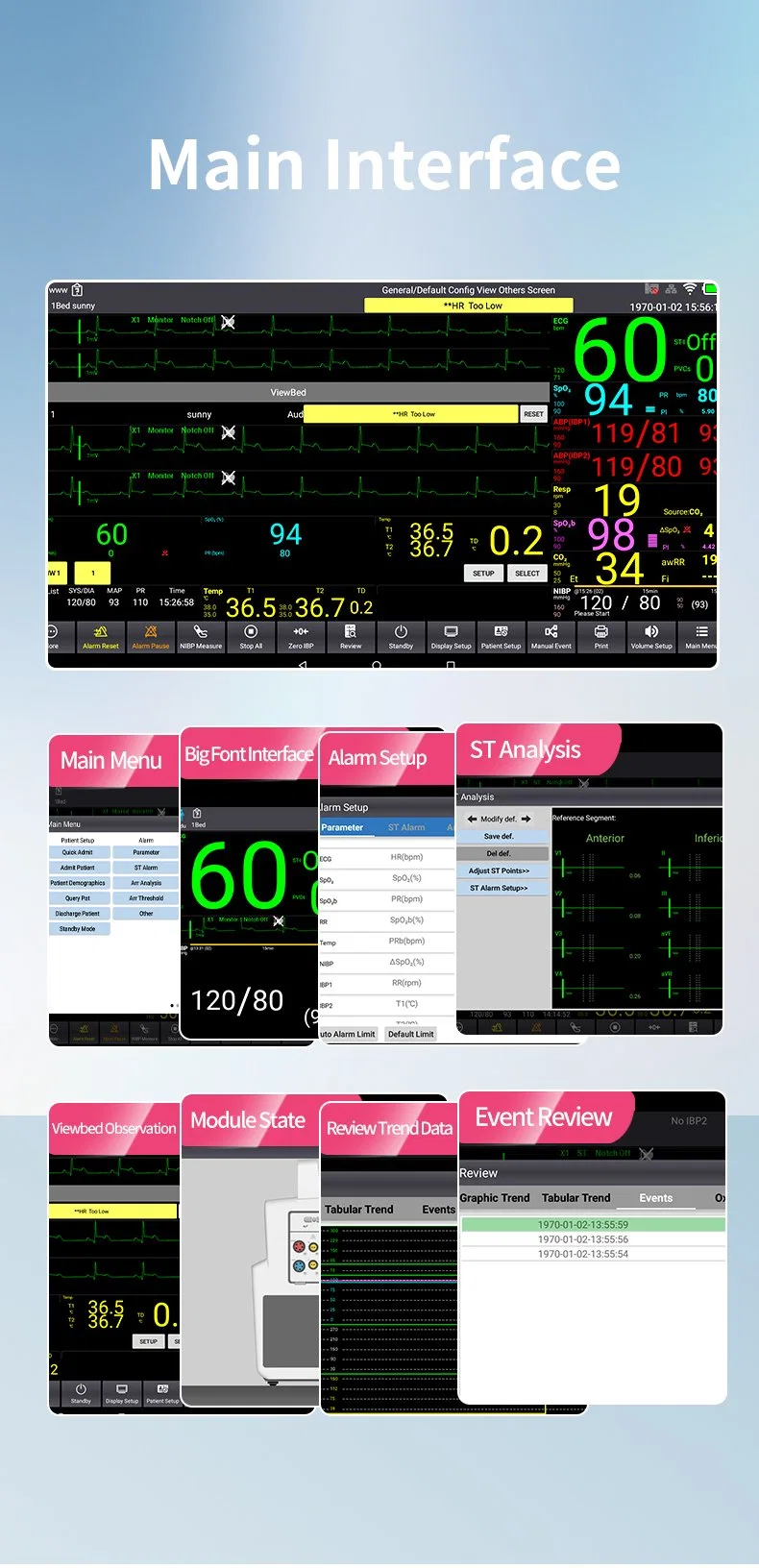 Touch Screen Built-in Large-Capacity Removable Rechargeable Probe Sp02 Plug in Patient Monitor