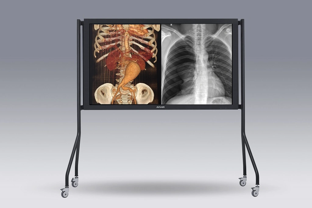 (JUSHA-SUPER70T-AIO) 70 Inch Grayscale and Color Auto-Calibration Group Consultation Medical Display, Large Dimension