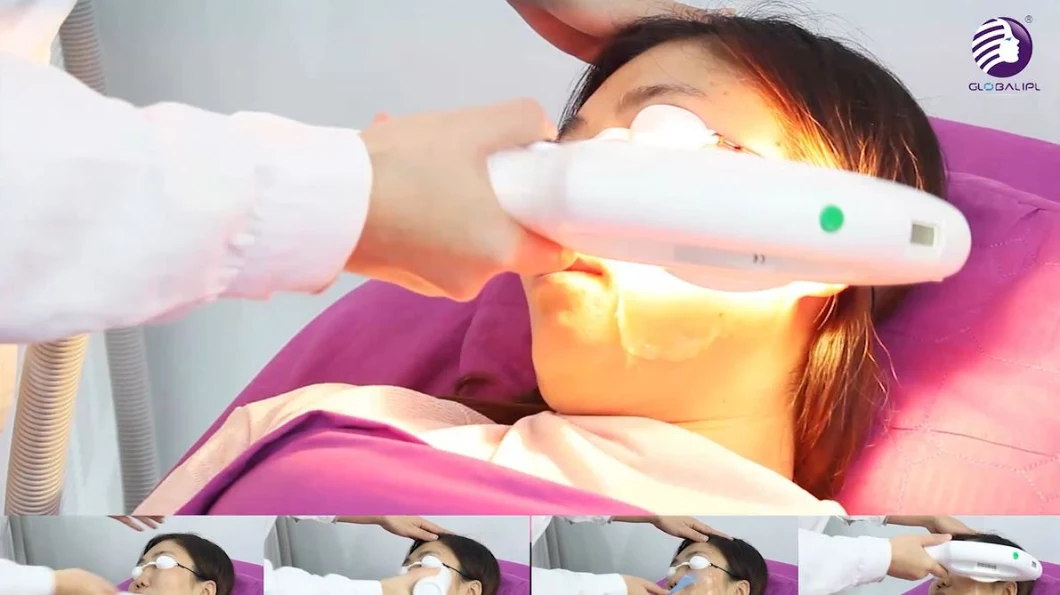 Super Hair Removal Skin Rejuvenation IPL SSR IPL Beauty Machine