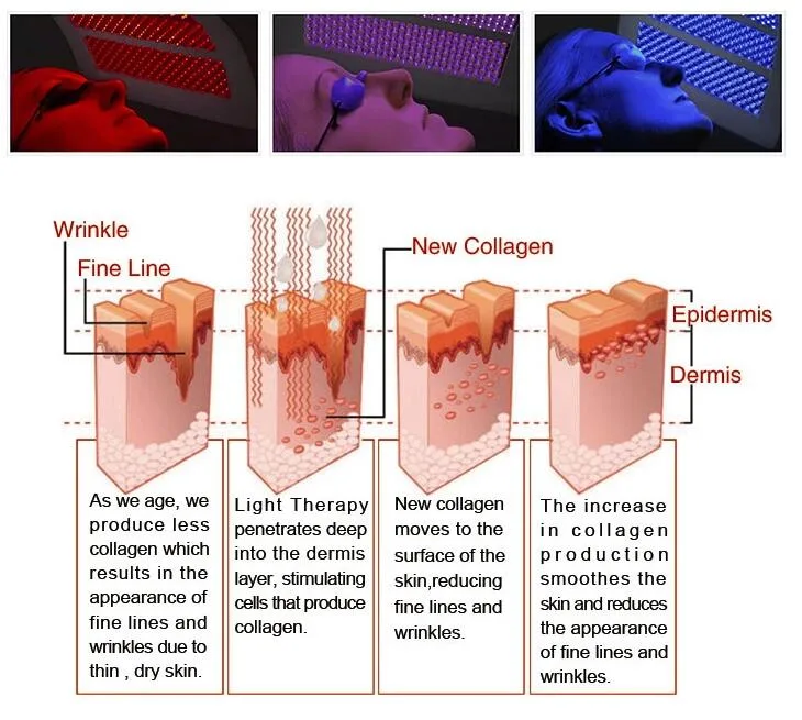 LED Light+PDT Red Blue Light Anti-Aging Therapy for Skin Rejuvenation Beauty System