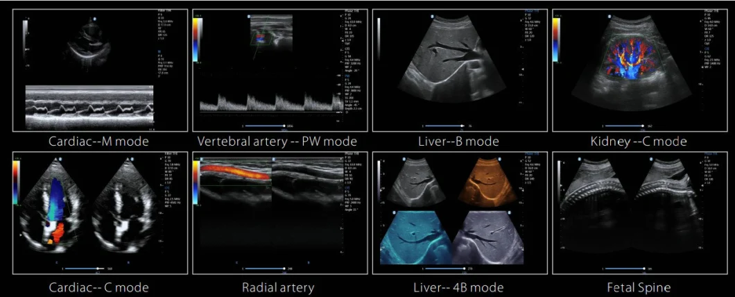 Ecography 4D Color Doppler Laptop Ultrasound Scan Machine FDA Approved