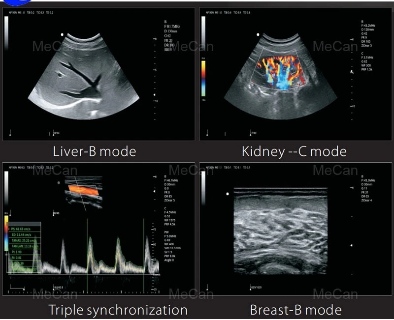 Trans-Vaginal Probe Scanner Veterinary Portable Welld Ultrasound Machine with High Quality MCU-CD001