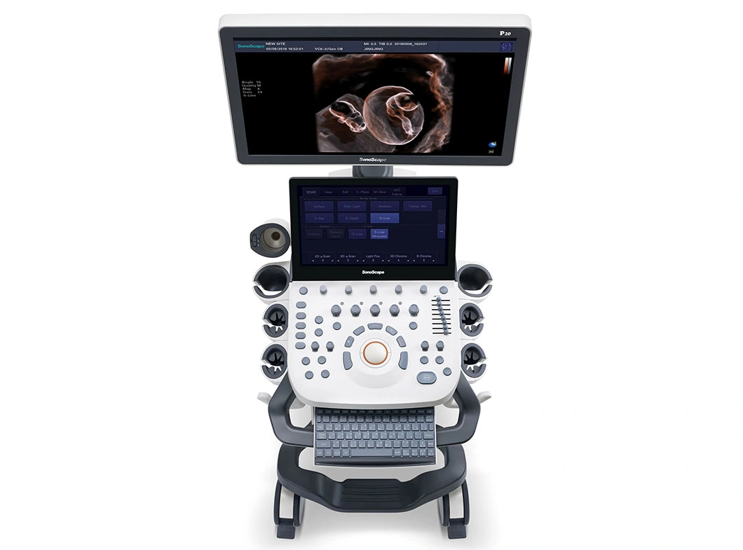 4D Diagnostic Technology Sonoscape P20 Color Doppler Ultrasound Machine