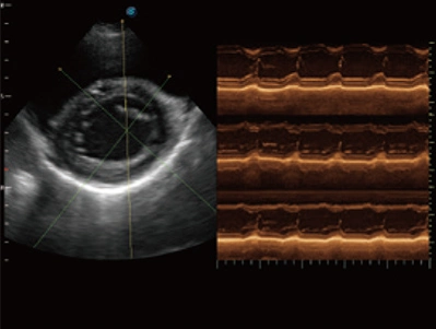 4D Diagnostic Technology Sonoscape P20 Color Doppler Ultrasound Machine