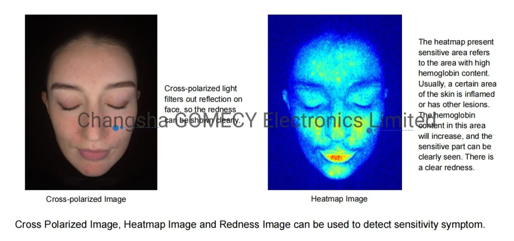 Facial Diagnosis Skin Analyser Skin Analyzer