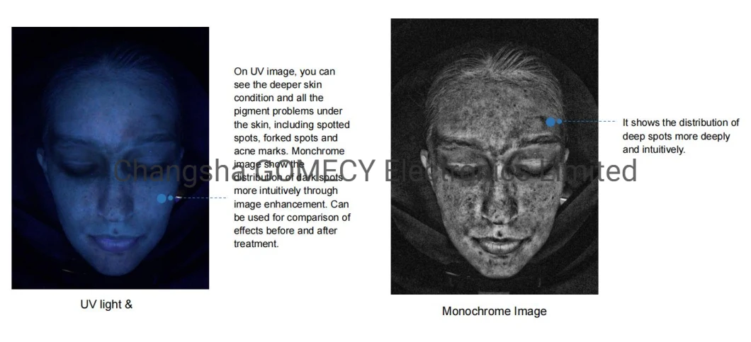 Facial Diagnosis Skin Analyser Skin Analyzer