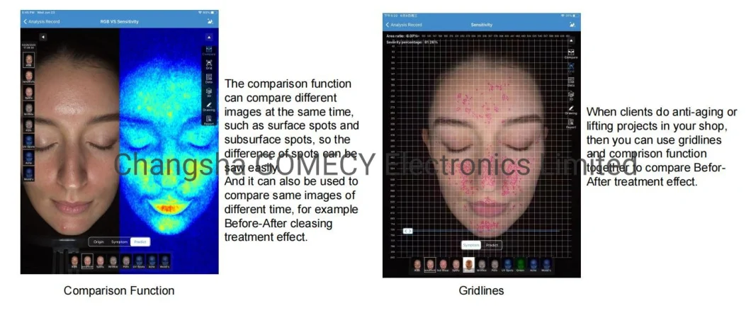 Facial Diagnosis Skin Analyser Skin Analyzer