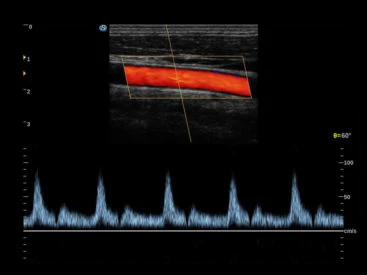 Sonoscape P20 Digital Color Ultrasound Equipment Trolley Mobile 3D 4D Doppler Ultrasound Scanner Machine