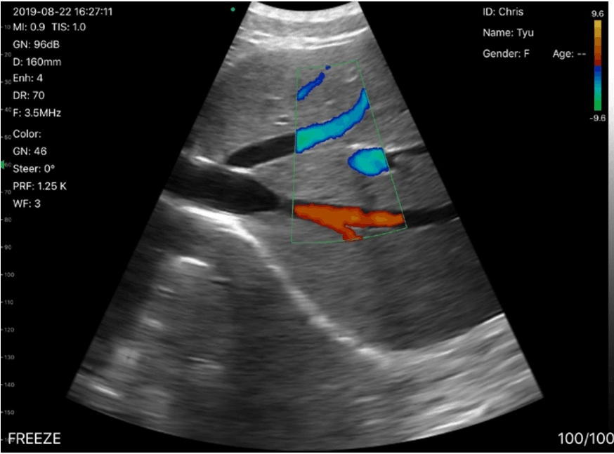 2021 CE Sells Well with 192 Matrix Wireless Ultrasound Probe 3 in 1