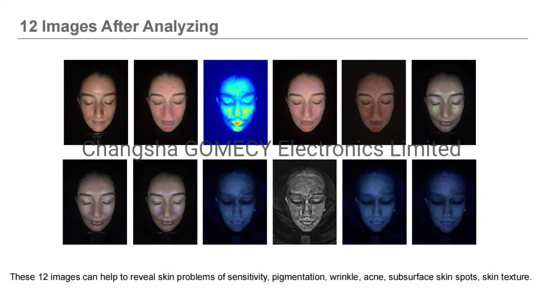 High Quality UV Light Magic Mirror Analyzer Machine for Skin Analyzer SPA