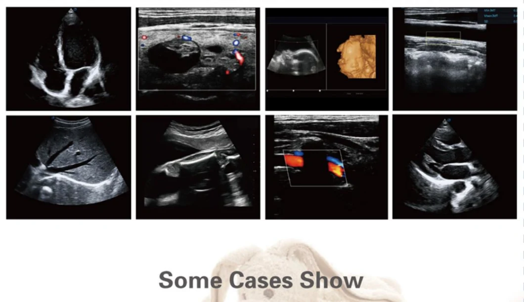 Cost-Effective High Quality 4D Iamge Echography Ultrasound Scan for Cardiologist Dw-P60