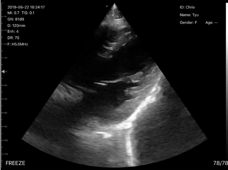 2021 CE Sells Well with 192 Matrix Wireless Ultrasound Probe 3 in 1