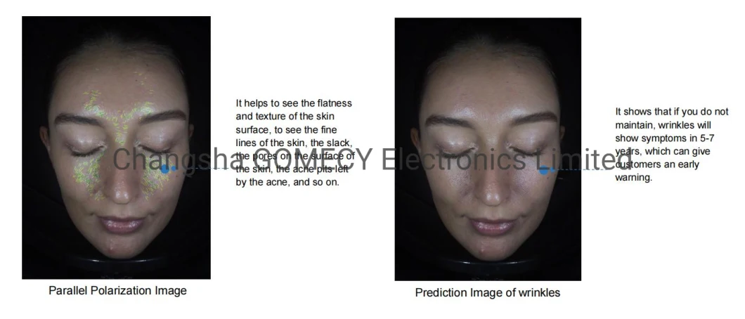 Hot Sale 3D Facial Analysis Equipment Skin Scanner