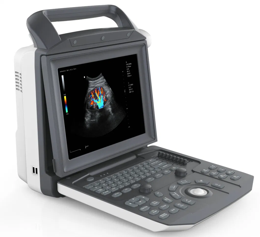 Ecography 4D Color Doppler Laptop Ultrasound Scan Machine FDA Approved